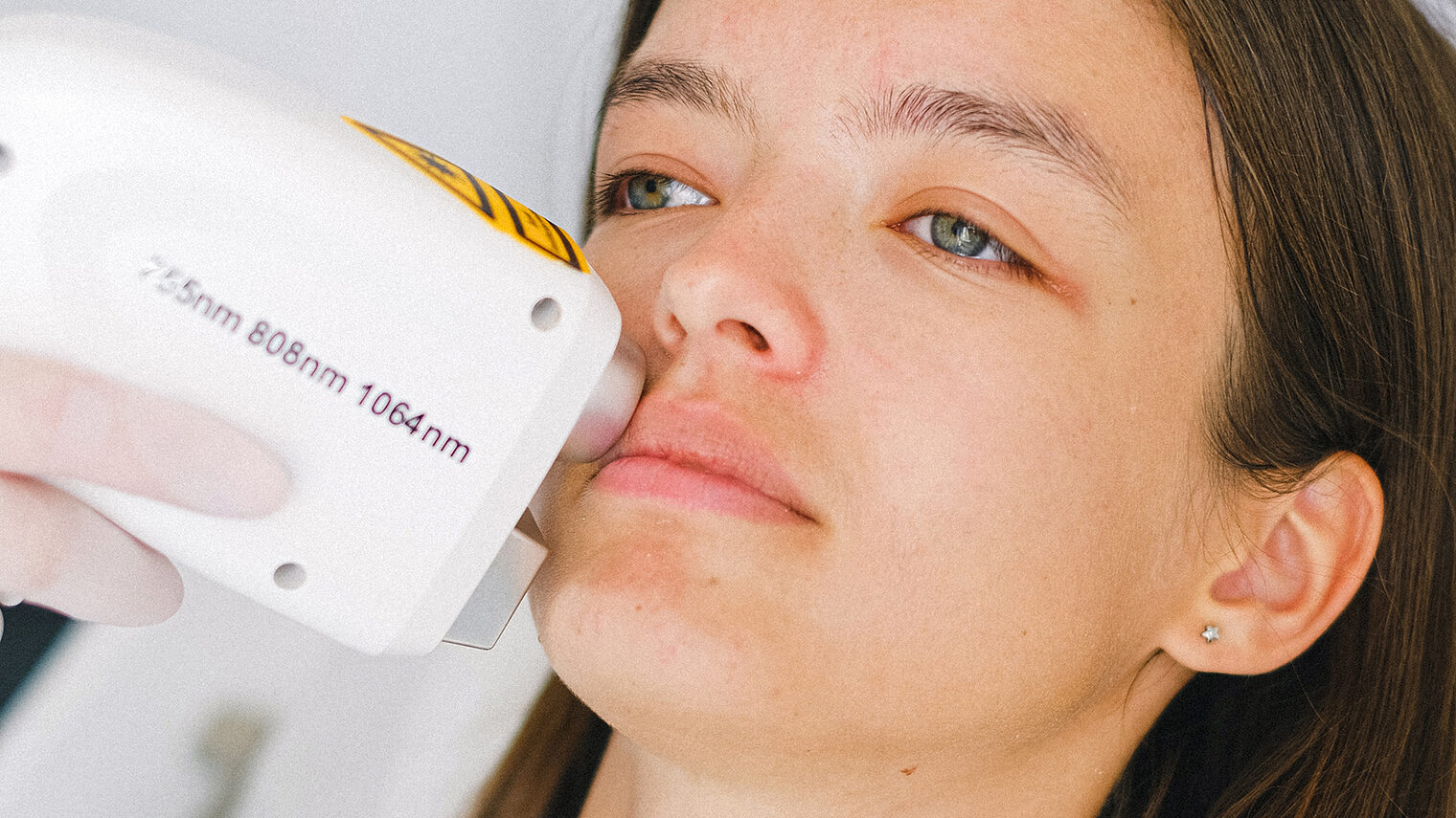 Kosmetische Anwendung mit Lasergerät im Gesicht einer Frau.