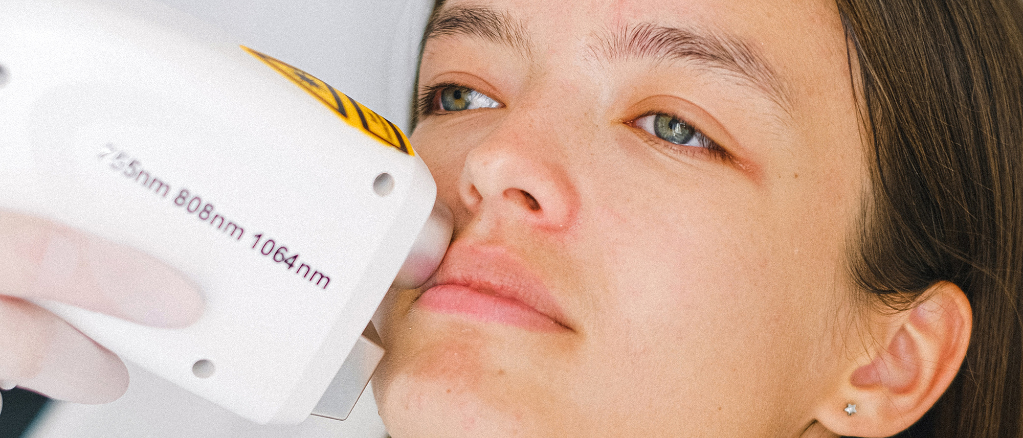 Kosmetische Anwendung mit Lasergerät im Gesicht einer Frau.